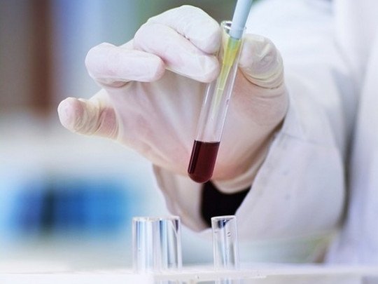 Не было тест-систем: в Тернопольской области коронавирус у женщины обнаружили только после смерти