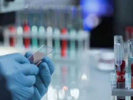 В Киеве антирекорд — за сутки 142 заболевших, в лидерах — Днепровский район