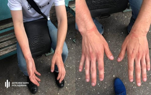 Патрульный, который сломал 17-летнему одесситу, предстанет перед судом: подробности