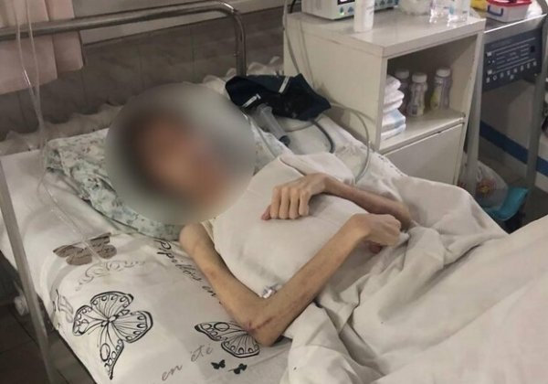 Гематомы и странное масло: отец, заморивший голодом 16-летнего одессита, рассказал о порче