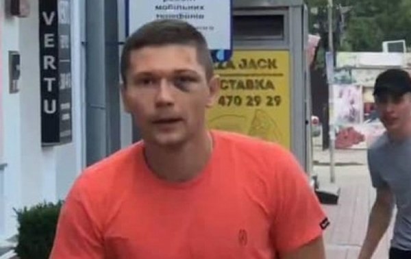 Сотрудник госохраны избил танцора Дорофеевой