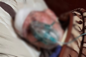 Отправили умирать с разбитой головой: в одесской больнице залечили пенсионера с Covid-19