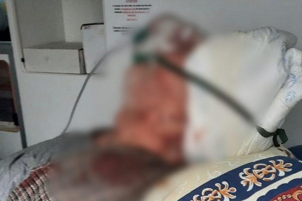 Отправили умирать с разбитой головой: в одесской больнице залечили пенсионера с Covid-19