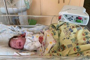 В Одессе медики спасли двух младенцев, которые весили менее 900 грамм 