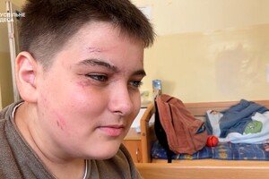 Двое братьев из Сергеевки, которые пострадали от ракет и остались сиротами, лечатся в Австрии