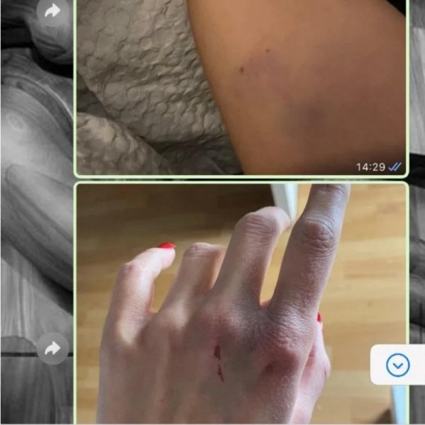 Бив у живіт вагітну дівчину: футболіст збірної Німеччини потрапив у гучний скандал