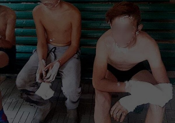 В Одесской области трое детей нашли банку с порохом и получили ожоги