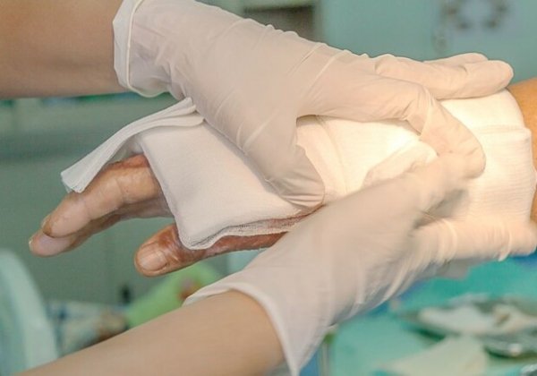 В Одесской области трое людей обожглись паром из котла: среди пострадавших малолетний ребенок