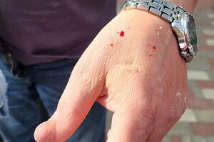 В Одессе полоз покусал директора зоопарка: куда обращаться, если заметили змею 